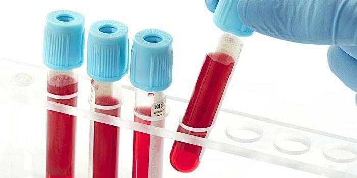 Testes de sangue in vitro