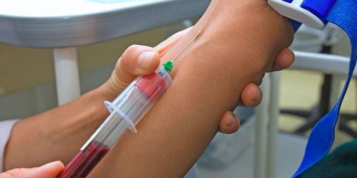 Toma de muestras de sangre de una vena.
