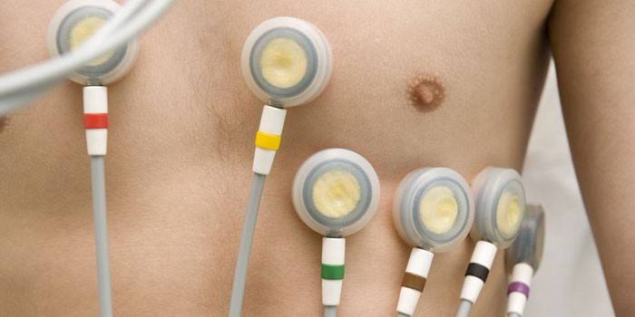 Eletrocardiograma de coração para homens