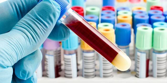 Prueba de sangre