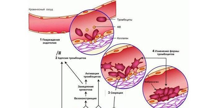 Schéma vaskulárnej hemostázy doštičiek