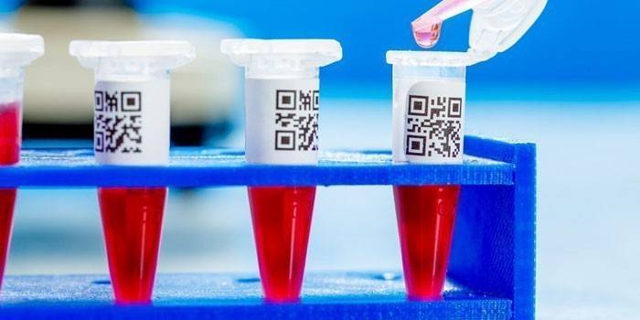 Krvný test