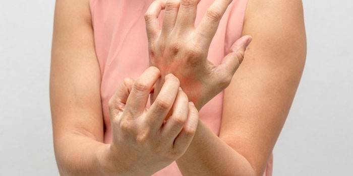 Mujer rasca la piel de la mano
