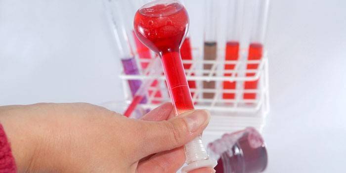 Badanie krwi in vitro