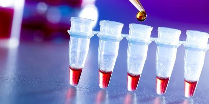 Test tüpü kan testi
