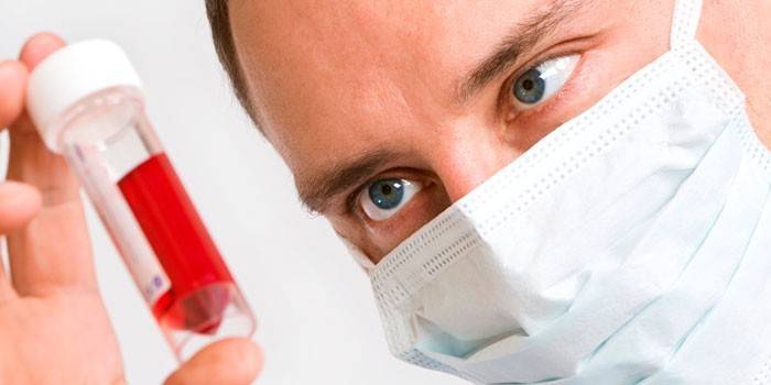 El médico realiza un análisis de sangre.