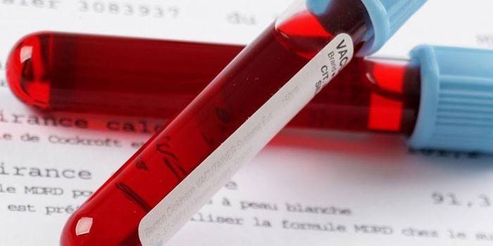 Tubos de sangre para análisis