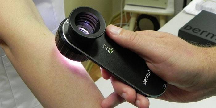 nesúci dermatoskopia