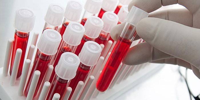 Krvné testy in vitro