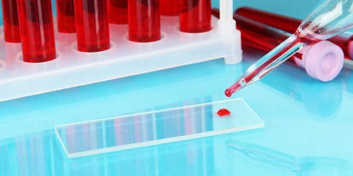 Prueba de sangre
