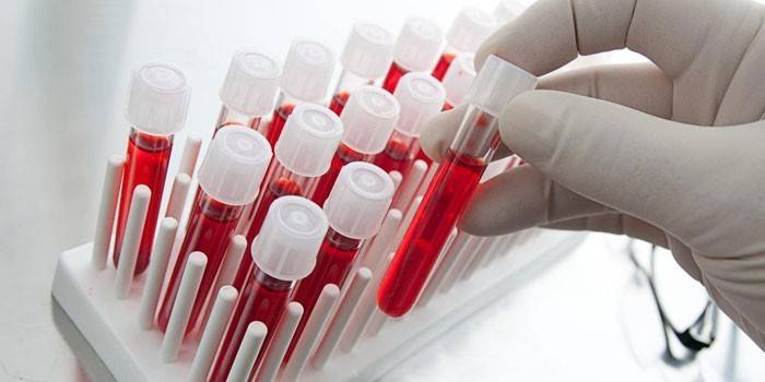 Krvné testy in vitro
