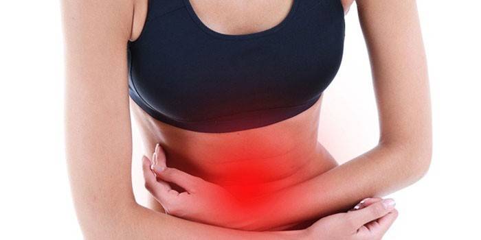El herpes zóster en el abdomen de una mujer.