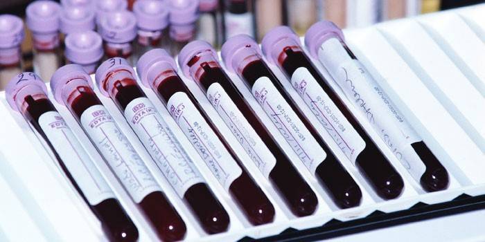 Testes de sangue in vitro