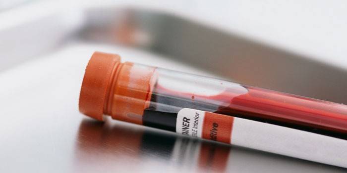 Krvný test in vitro