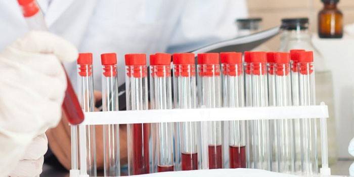 Análisis de sangre in vitro
