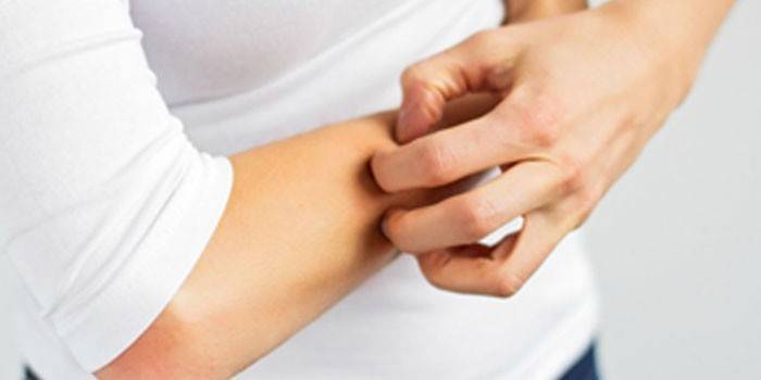 Mujer rasca su mano
