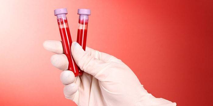 Análisis de sangre in vitro