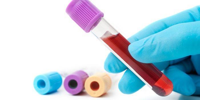 Krvný test in vitro