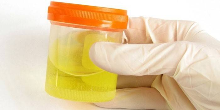 Urinálise em um recipiente
