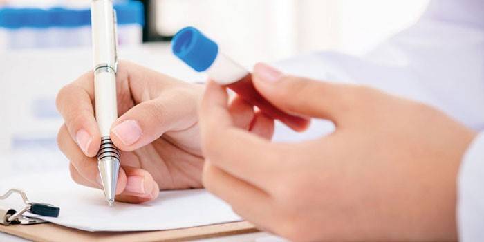 Medic grava os resultados dos testes e segura um tubo de ensaio com sangue na mão