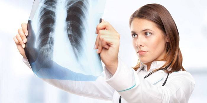 Doctora mira una radiografía