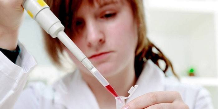 Technik laboratoryjny robi badanie krwi