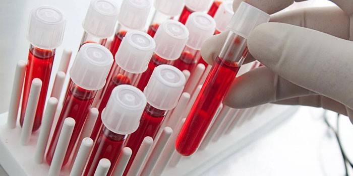 Badania krwi in vitro
