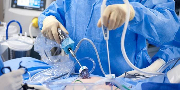 O cirurgião realiza uma operação laparoscópica