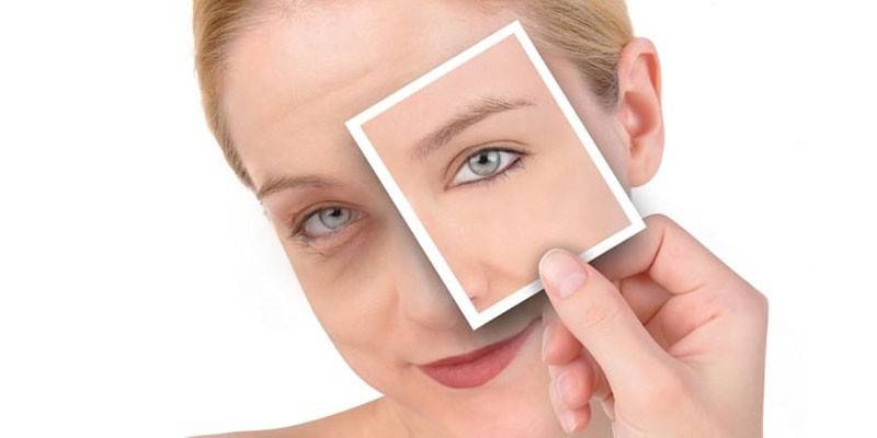 Círculos oscuros debajo de los ojos de la niña