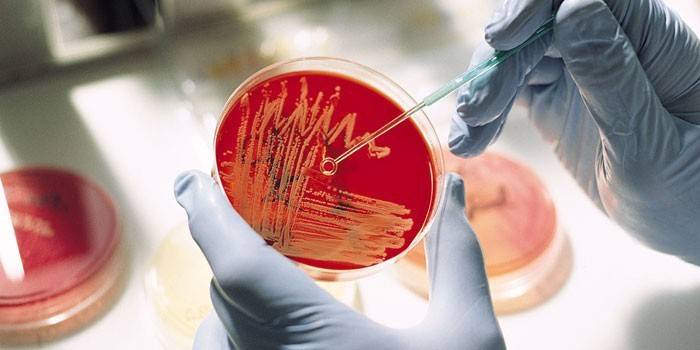 Cultura microbiológica