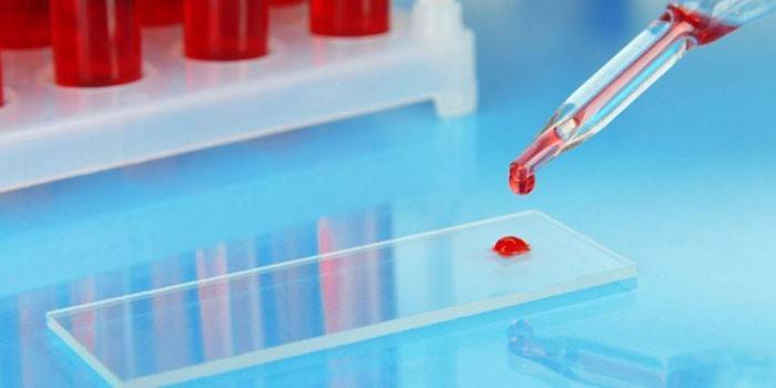 Kropla krwi z pipety na szklance laboratoryjnej