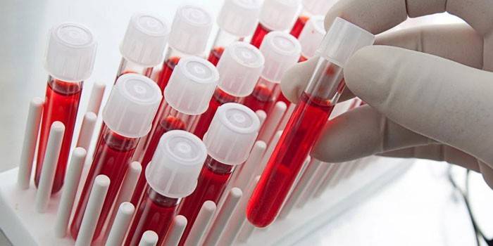 Krvné testy in vitro