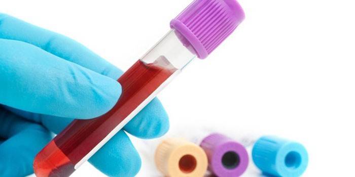 Análisis de sangre in vitro