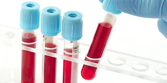Testes de sangue in vitro
