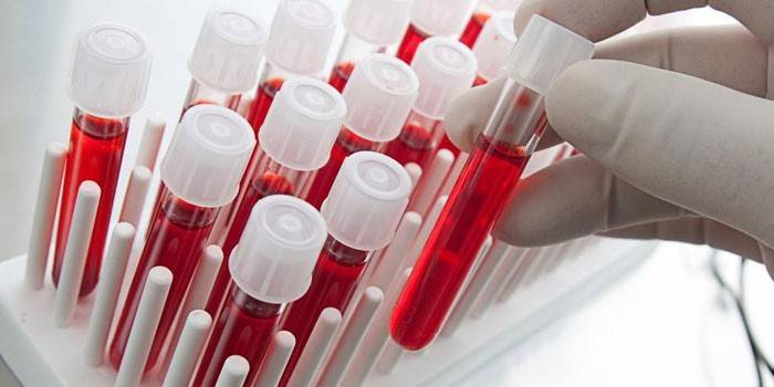 Krvné testy in vitro