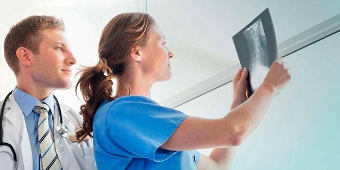 Los doctores miran una radiografía