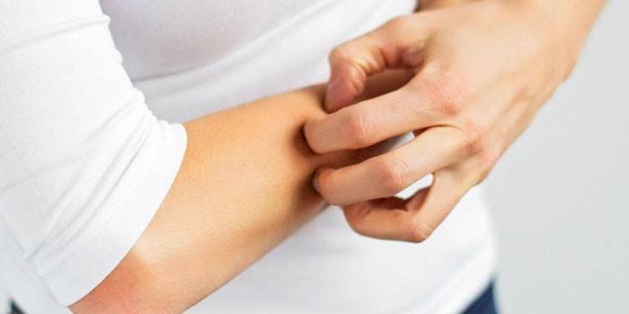 Chica rasca su mano