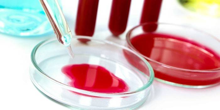 Exame de sangue