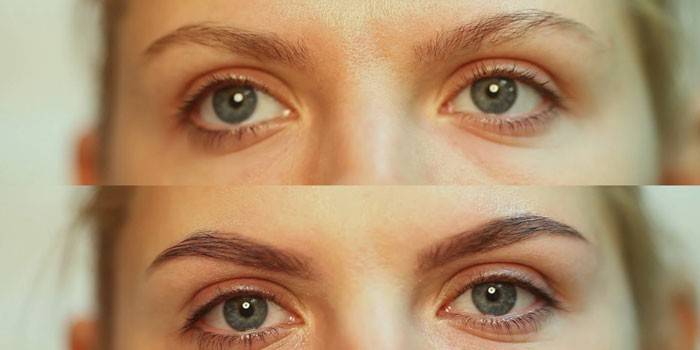 Antes e depois das fotos