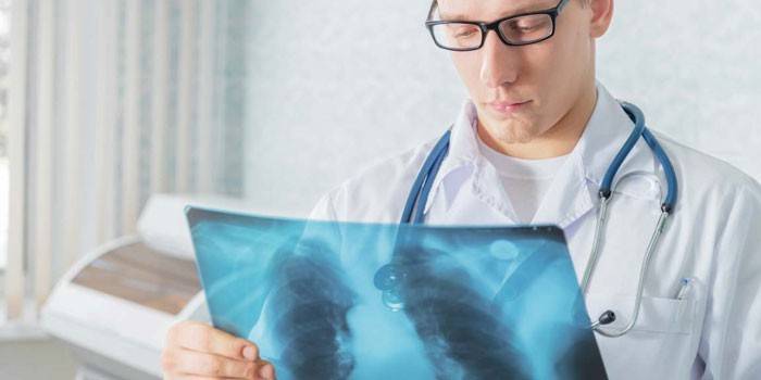 El médico examina la imagen de un paciente.
