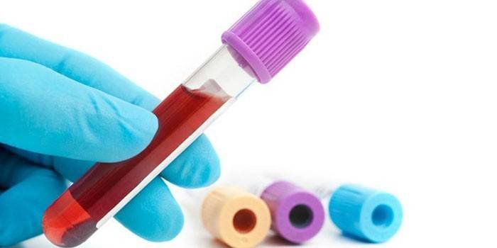 Exame de sangue