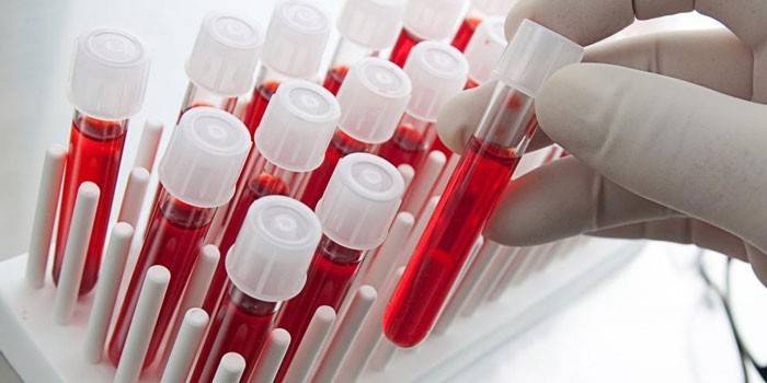 Krvné testy in vitro
