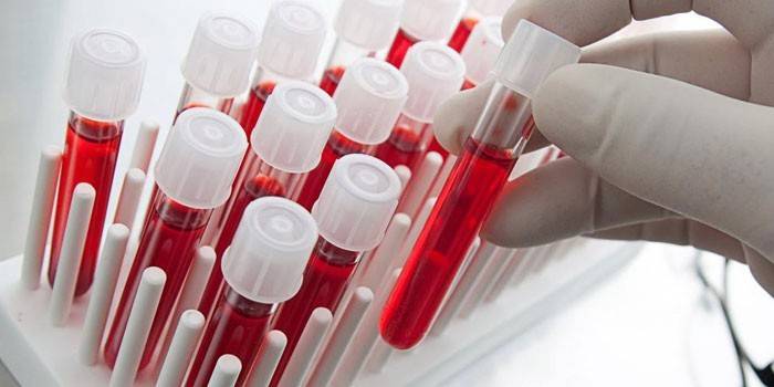 Krvné testy in vitro