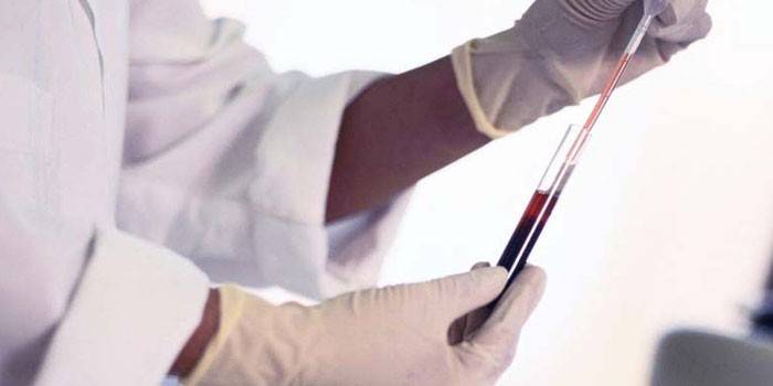 Technik laboratoryjny przeprowadza badania krwi
