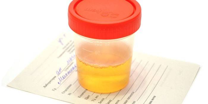 Urinálise em um recipiente
