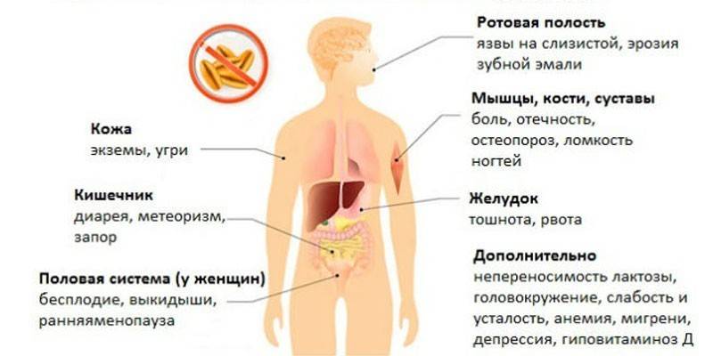 Príznaky intolerancie lepku
