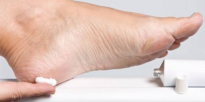 Mujer lubrica una crema para pies