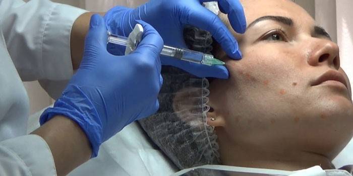 Biorevitalización