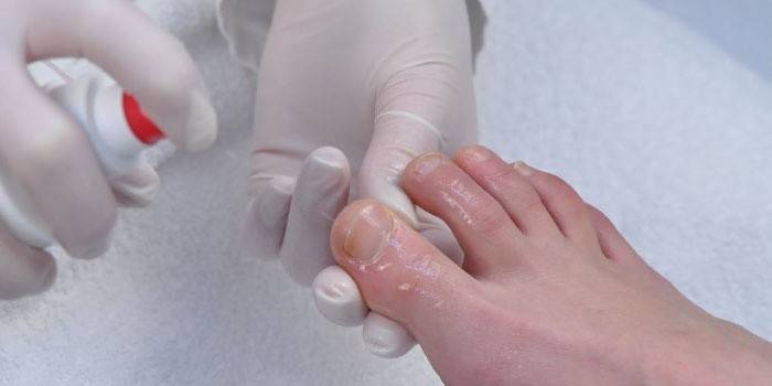 Spray para los pies