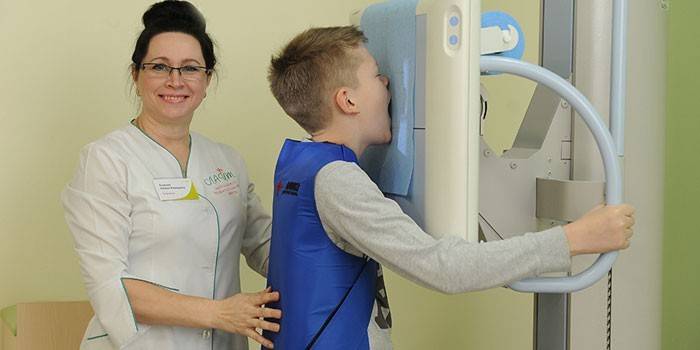 X-ray chlapca